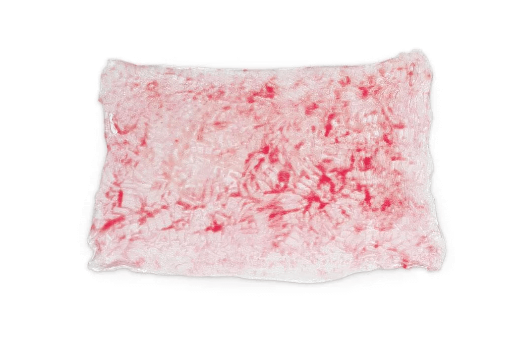 Simulierte Verbrennungen 2. Grades (oberflächlich) - Erler - Zimmer